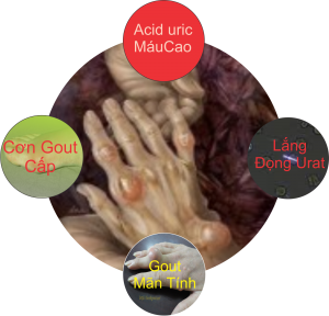 chế độ ăn cho người bệnh gút - hình minh họa 2