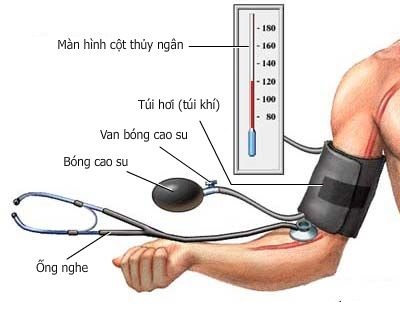 cao huyet ap la gi 11 Cao huyết áp là gì?