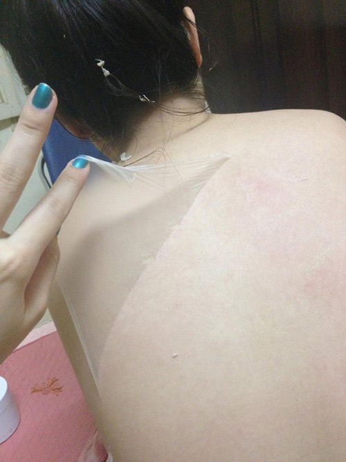 sản phẩm làm đẹp gây hại - hình minh họa 2