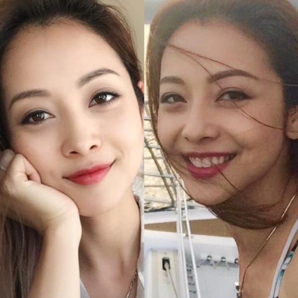 thẩm mỹ cắt mí mắt - hình minh họa 3